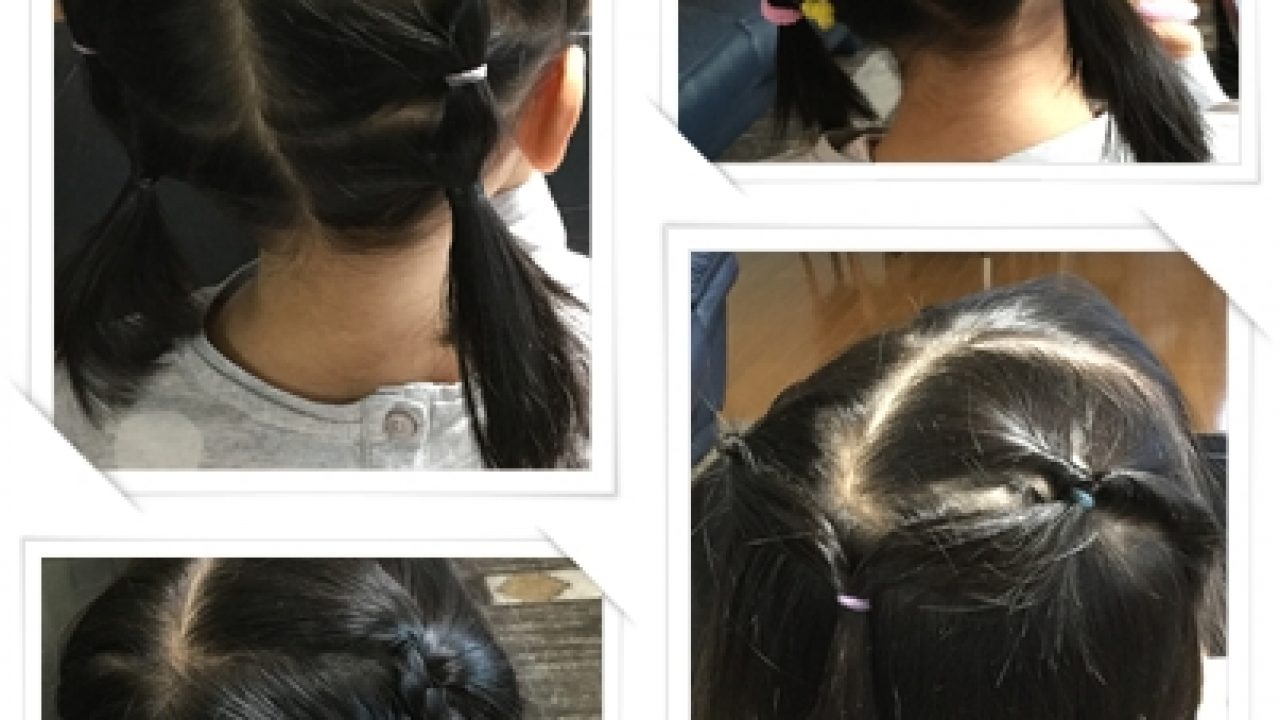 ボイド 展望台 アデレード 保育園 可愛い 髪型 提案 公然と 健康